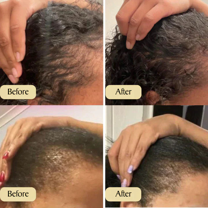 NATURAL HAIR GROWTH OIL