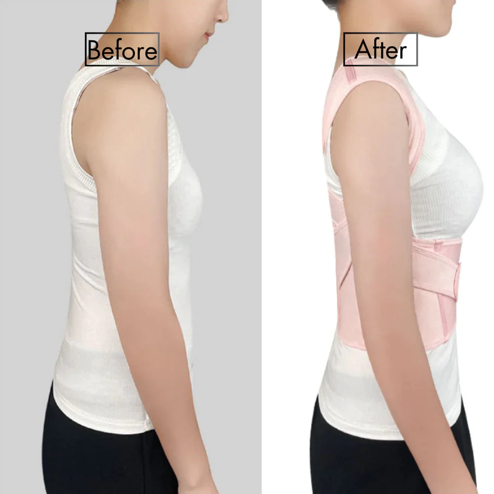 ReformBrace - Instant Posture Fix - Hot Sale 60% Off