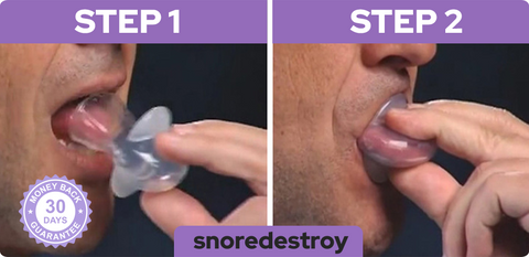 Anti-Snore Mouth Guard