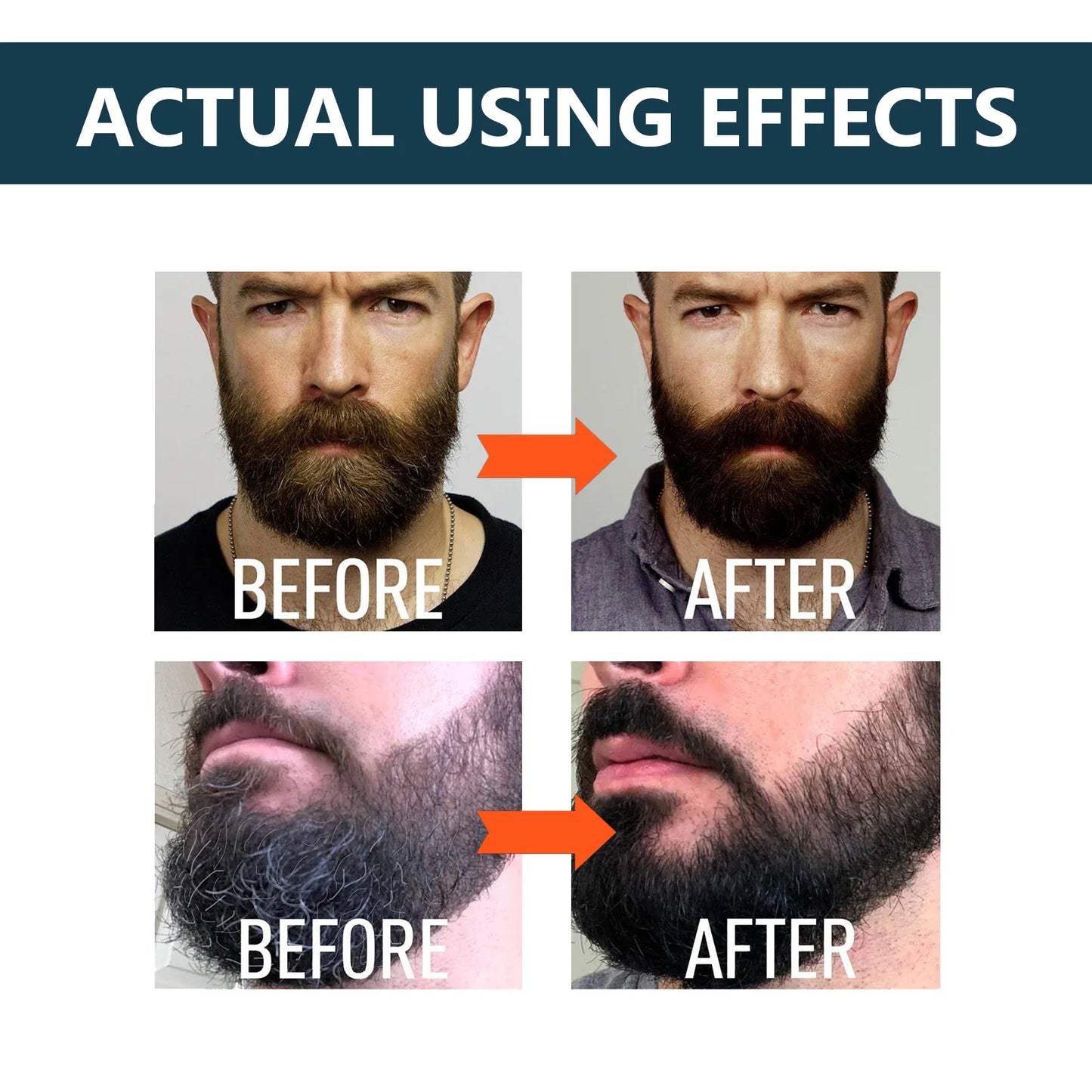 UNPREE Beard Growth & Strengthen Serum - Hot Sale 50% Off