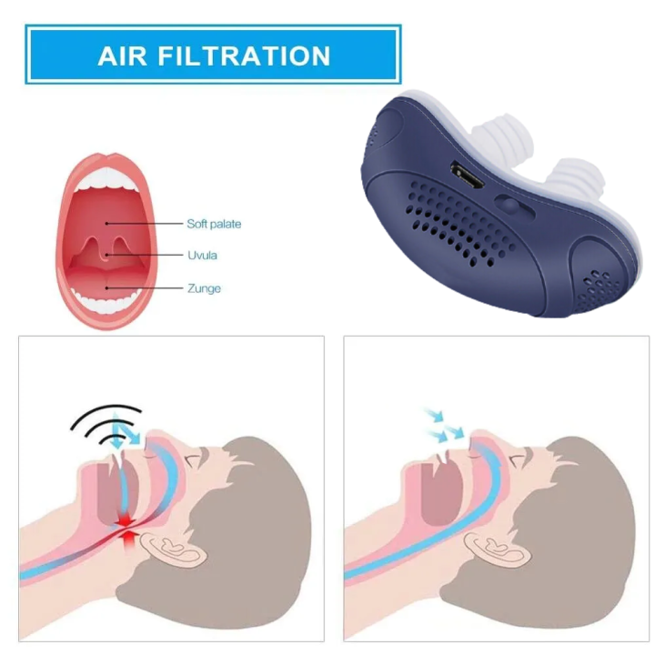 Hoseless, Maskless, Micro-CPAP Anti Snoring