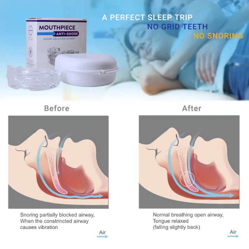 Silens Pro | Anti-snoring device