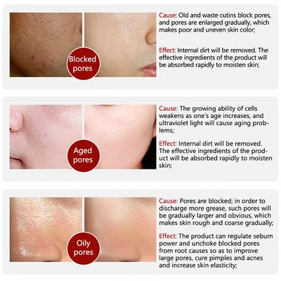 2023 New Magical Pore Eraser Waterproof Face Primer Stick LAST DAY BUY 1 GET 1 FREE