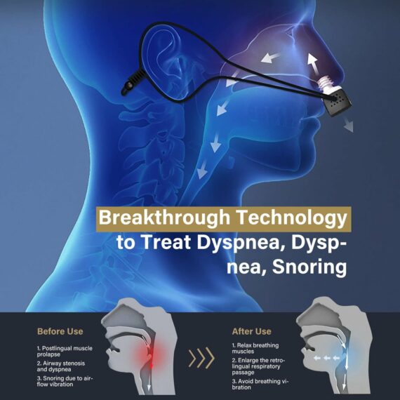 Airing: The First Hoseless, Maskless, Micro-CPAP