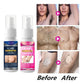 2023 New Sobeeriond Semi-permanent Hair Removal Spray - Last day early adopter price