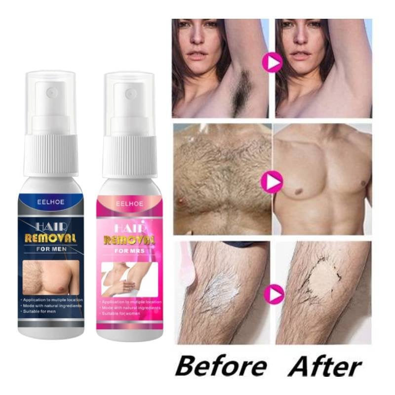 2023 New Sobeeriond Semi-permanent Hair Removal Spray - Last day early adopter price