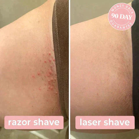 Laser Hair Remover- Hot Sale 70% Off