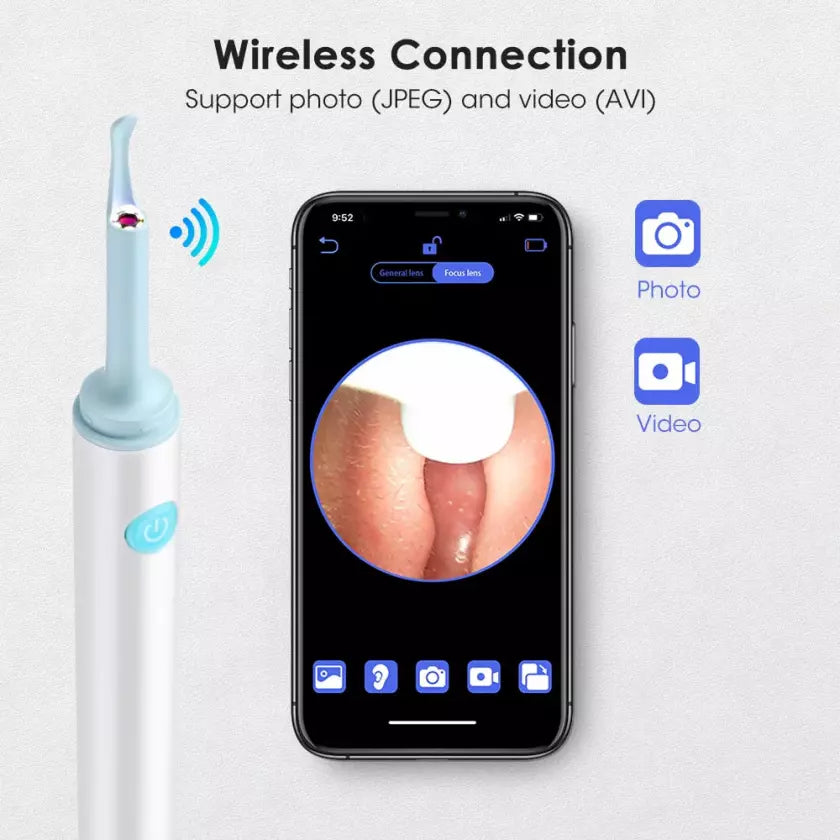 1080P Ear Wax Removal Camera (BUY 2 GET FREE SHIPPING) – (Last Day Promotion- SAVE 48% OFF)