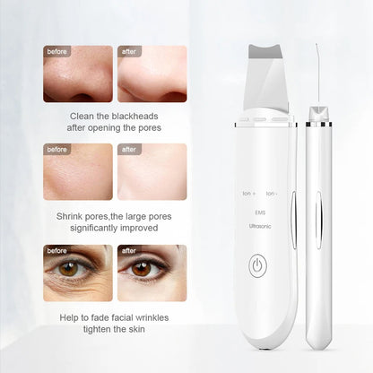 ULTRASONIC SKIN SCRUBBER DEEP FACE CLEANING MACHINE