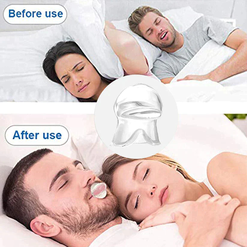 Snore Fixxer – Hot Sale 60% Off