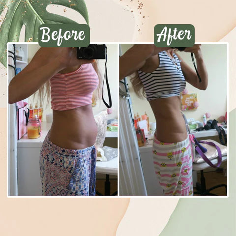 Perfect Detox Slimming Patch（Limited Time Discount Last Day）